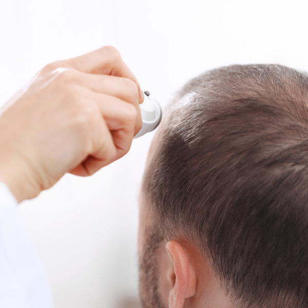 SDY Hair Saç Sorunları Merkezi